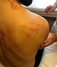 Cours Formation Massage Gua Sha thaï Bruxelles - Belgique