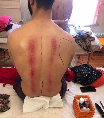 Cours Formation Massage Gua Sha thaï Module de base à Bruxelles - Belgique